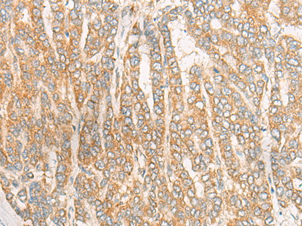 DKKL1 Antibody