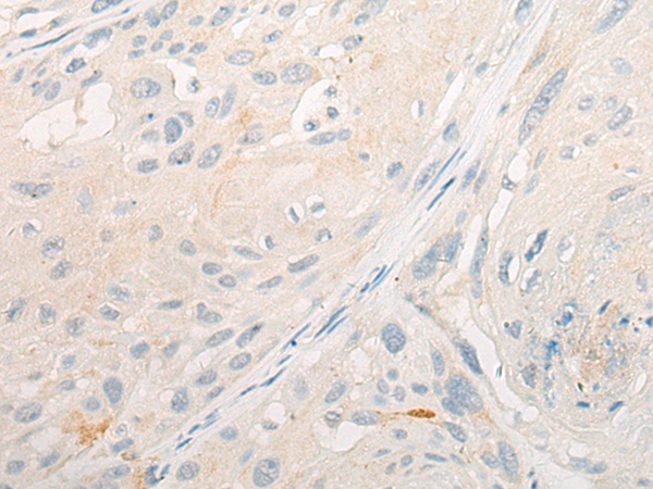 DLEC1 Antibody