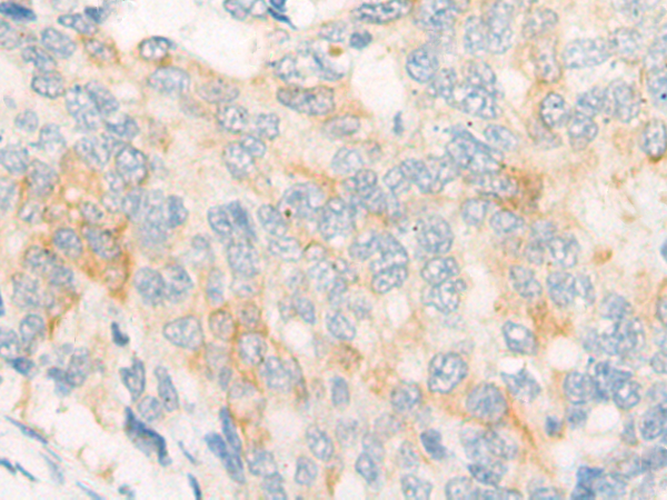 DLEC1 Antibody