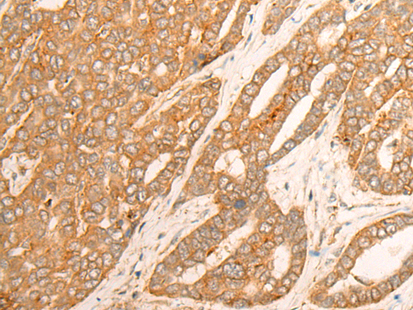 DLGAP4 Antibody