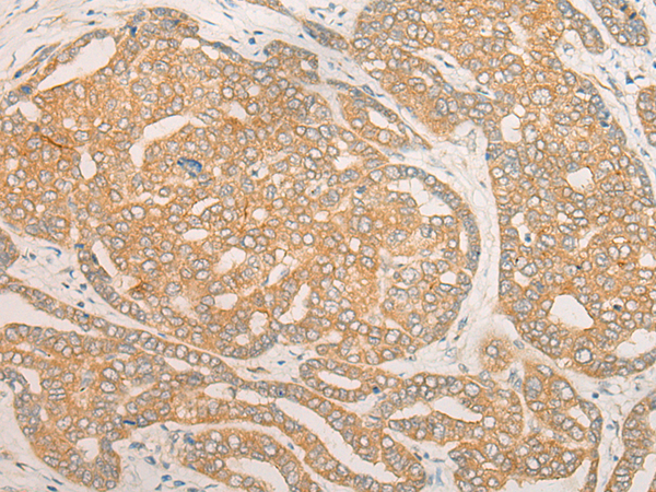 DMAP1 Antibody