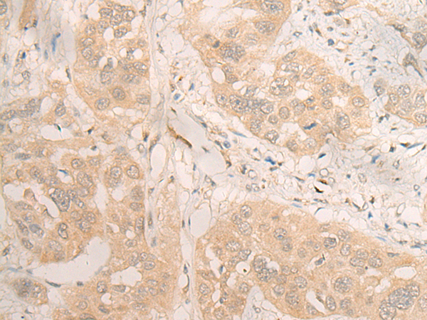 DMAP1 Antibody