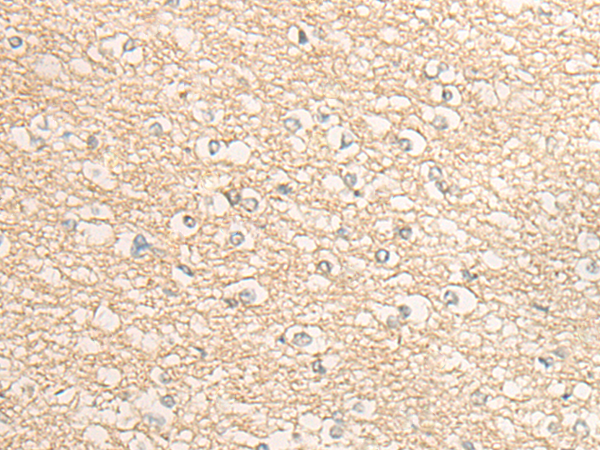 DMGDH Antibody