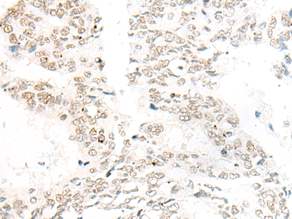 DNAJC9 Antibody