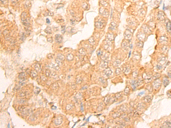 DSC3 Antibody