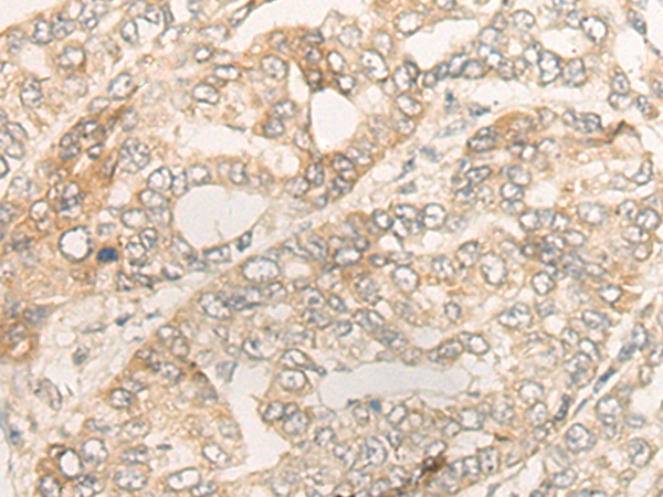 DUOX2 Antibody