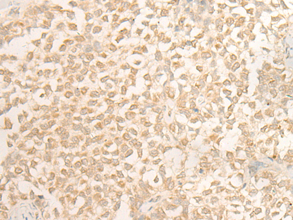 DUSP27 Antibody