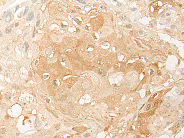 DUX4 Antibody