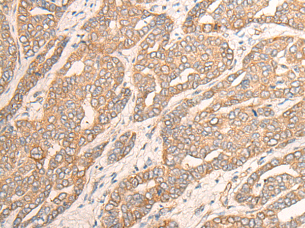 DYNC1LI1 Antibody