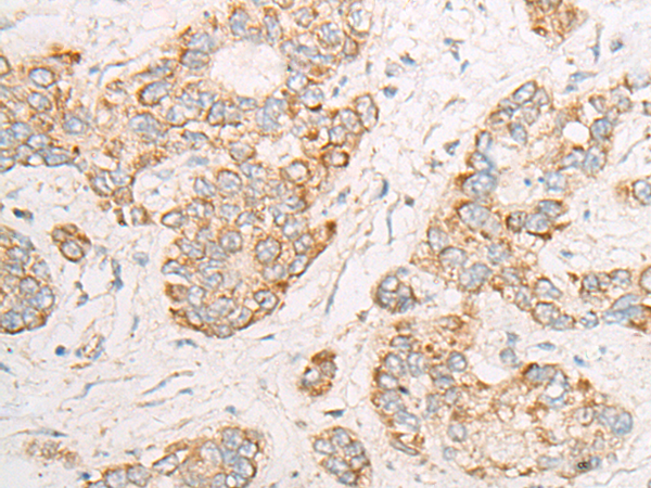 DYNC1LI2 Antibody