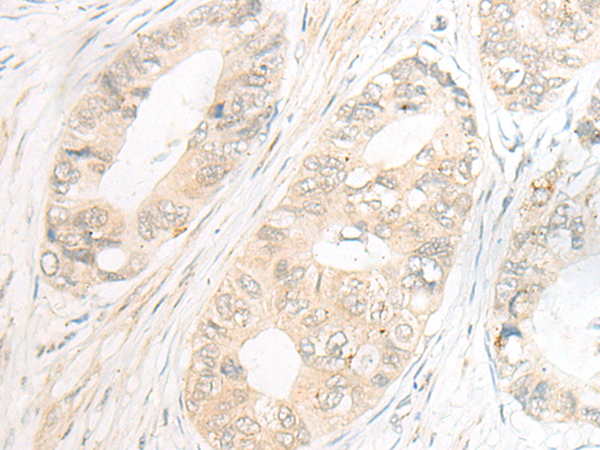 EBF2 Antibody