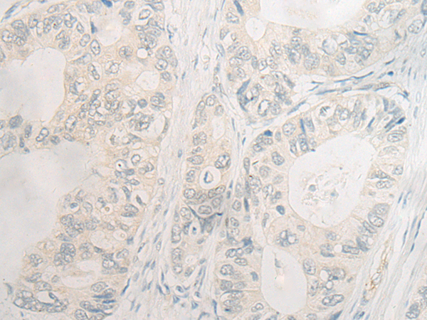 EDEM1 Antibody