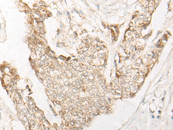 EEPD1 Antibody