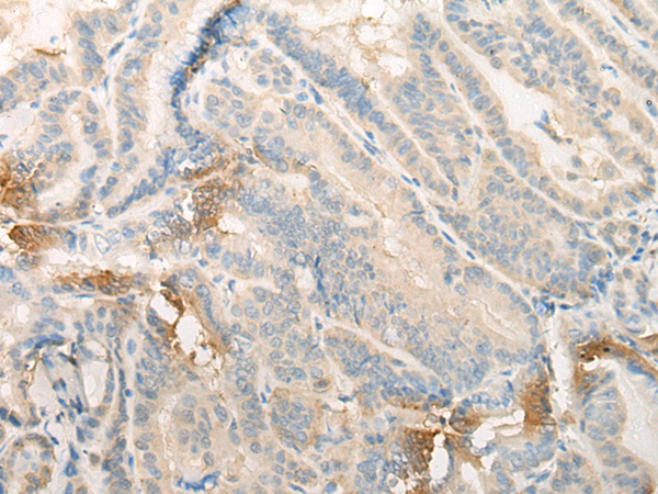 EFCAB5 Antibody