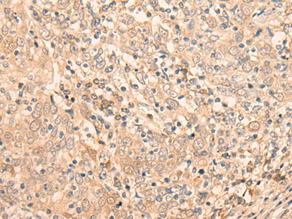 EIF2B5 Antibody