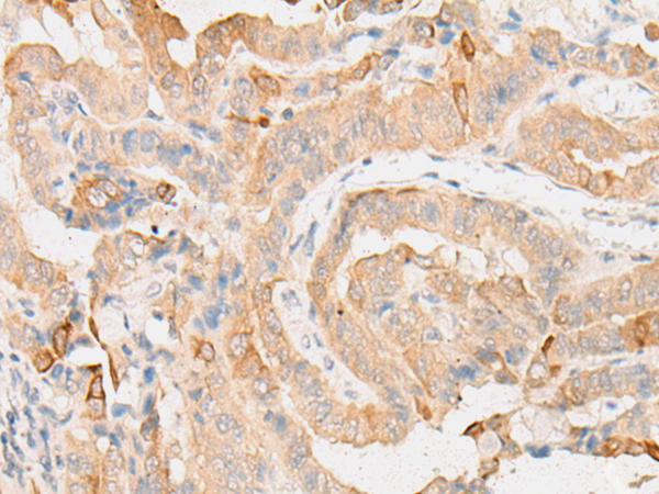 EIF2D Antibody