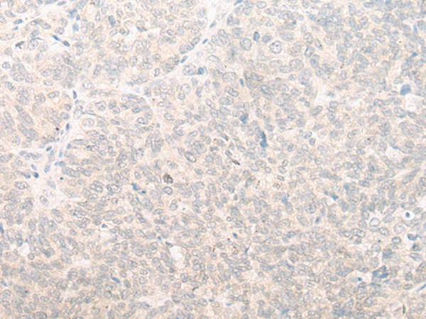 EIF2D Antibody