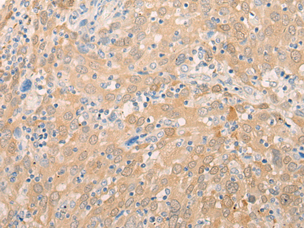 EIF3B Antibody