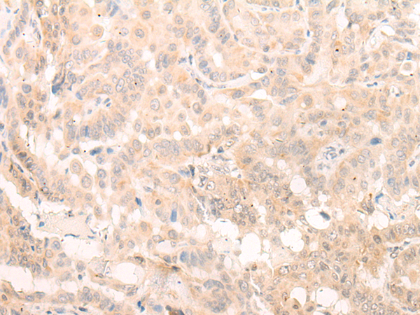 EIF3B Antibody