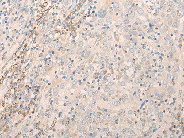 EIF3J Antibody