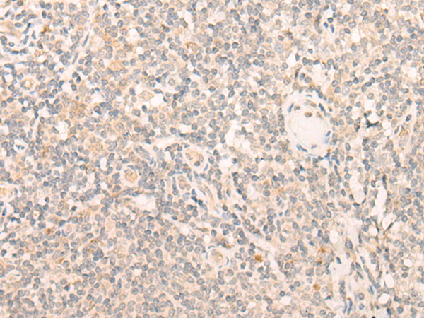 EIF3J Antibody