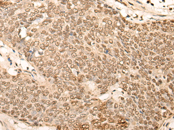 EIF4A3 Antibody