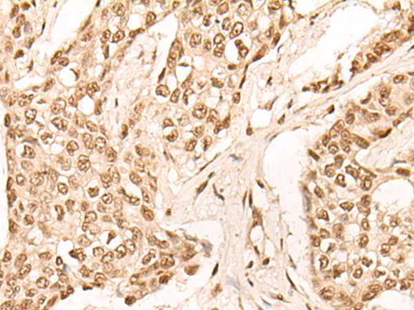 EIF4A3 Antibody