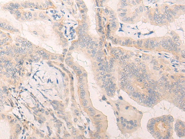 ELANE Antibody