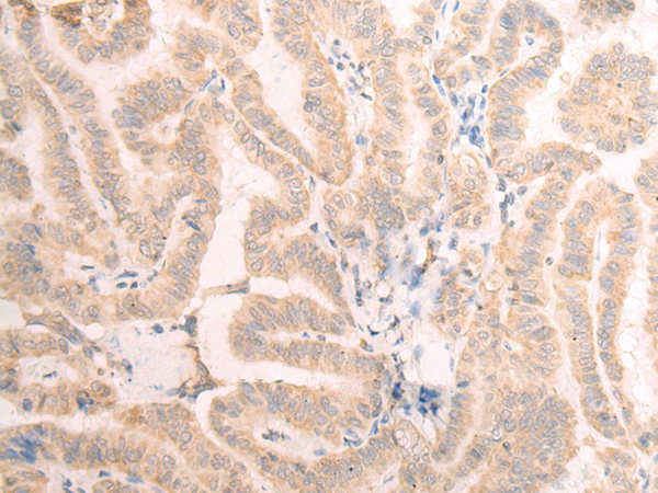 EME2 Antibody