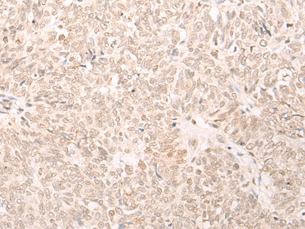 EME2 Antibody