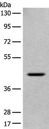 EME2 Antibody