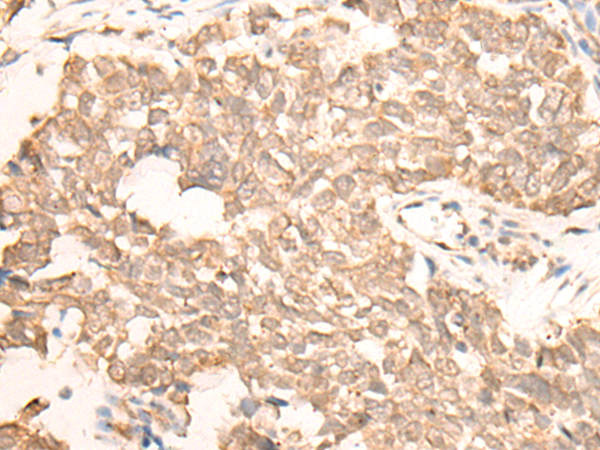 EMSY Antibody