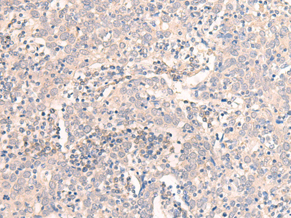 EMX1 Antibody