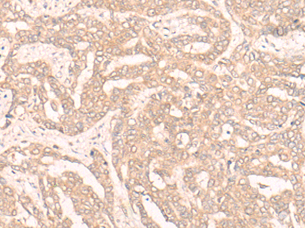 ENOSF1 Antibody