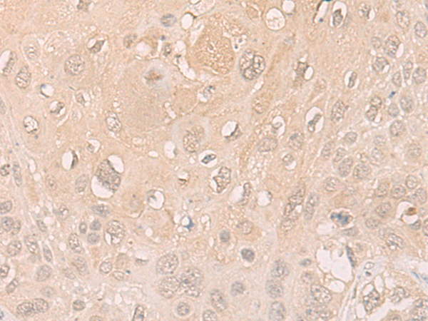 ENOSF1 Antibody