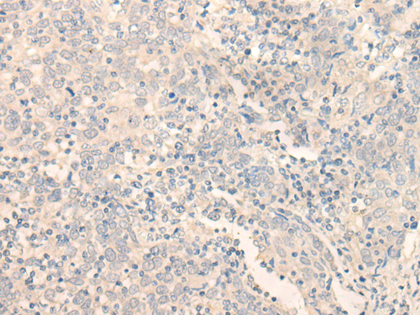 ERP27 Antibody