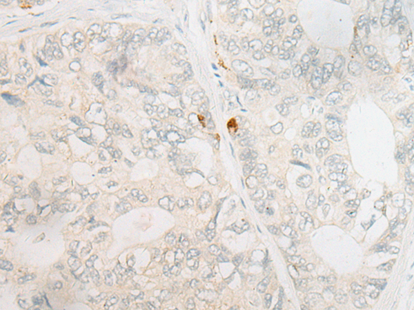 ESCO1 Antibody