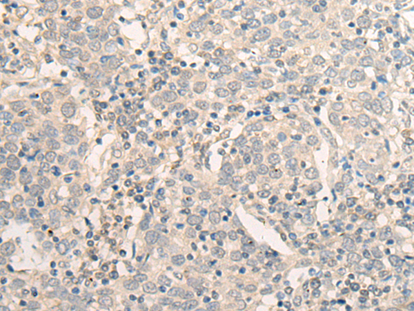 EXO5 Antibody