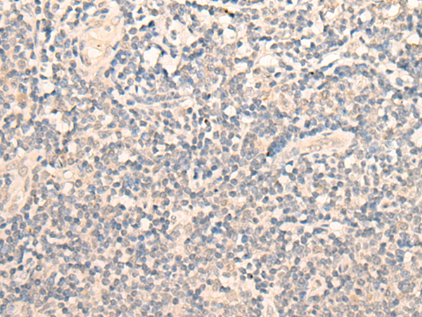 FADS3 Antibody