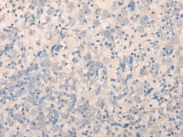 FAM91A1 Antibody