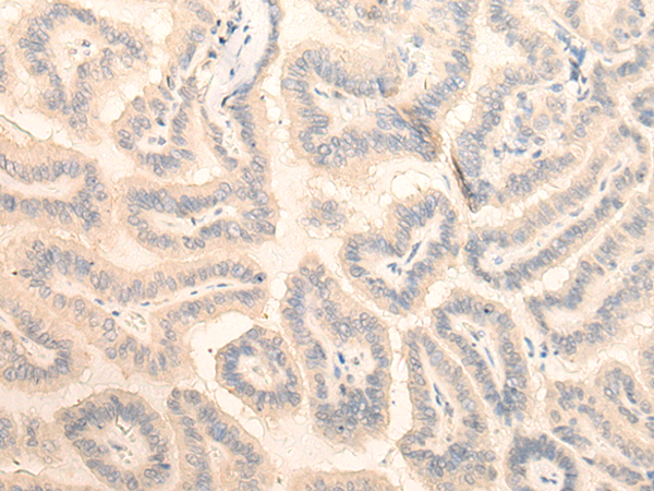 FAM98A Antibody