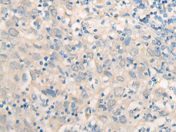 FSD1 Antibody