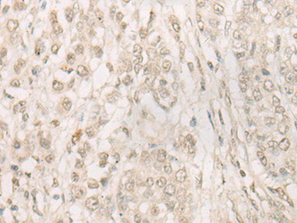 FSD1 Antibody