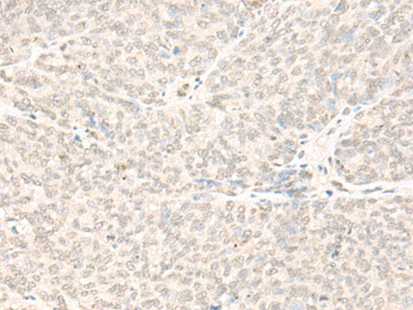 FTSJ3 Antibody