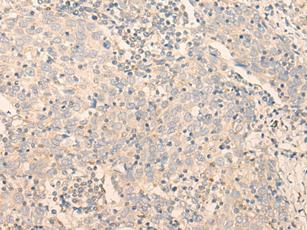 GCDH Antibody