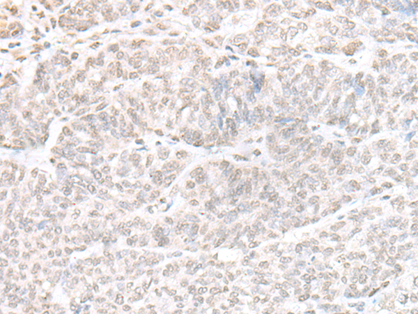 GPBP1L1 Antibody