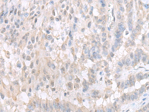 GPBP1L1 Antibody