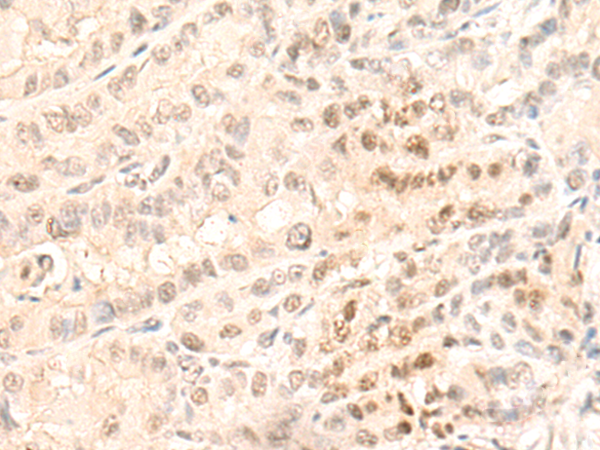 GTF2F1 Antibody