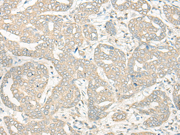 HLA-DRB5 Antibody