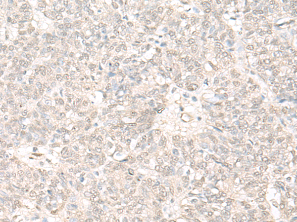 HSPA2 Antibody